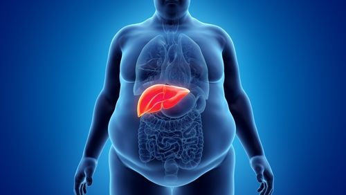 Manga gástrica y su eficacia contra el hígado graso