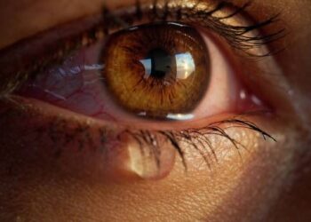 Tratamiento contra el cáncer de mama puede impactar la salud visual: Medical Dimegar