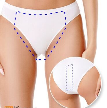 Tecnología YAG Candela facilita depilacion bikini brasileño en Kopay de Gele Giner